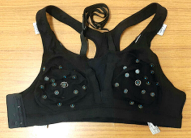 ಸ್ತನ ಕ್ಯಾನ್ಸರ್ ನ್ನು ಮೊದಲೇ ಪತ್ತೆ ಹಚ್ಚುವ ‘ಸ್ಪೋರ್ಟ್ಸ್ ಬ್ರಾ’ – ಮಲಬಾರ್ ಕ್ಯಾನ್ಸರ್ ಸೆಂಟರ್ ಅಭಿವೃದ್ಧಿಪಡಿಸಿದ ‘ಸ್ಪೋರ್ಟ್ಸ್ ಬ್ರಾ’